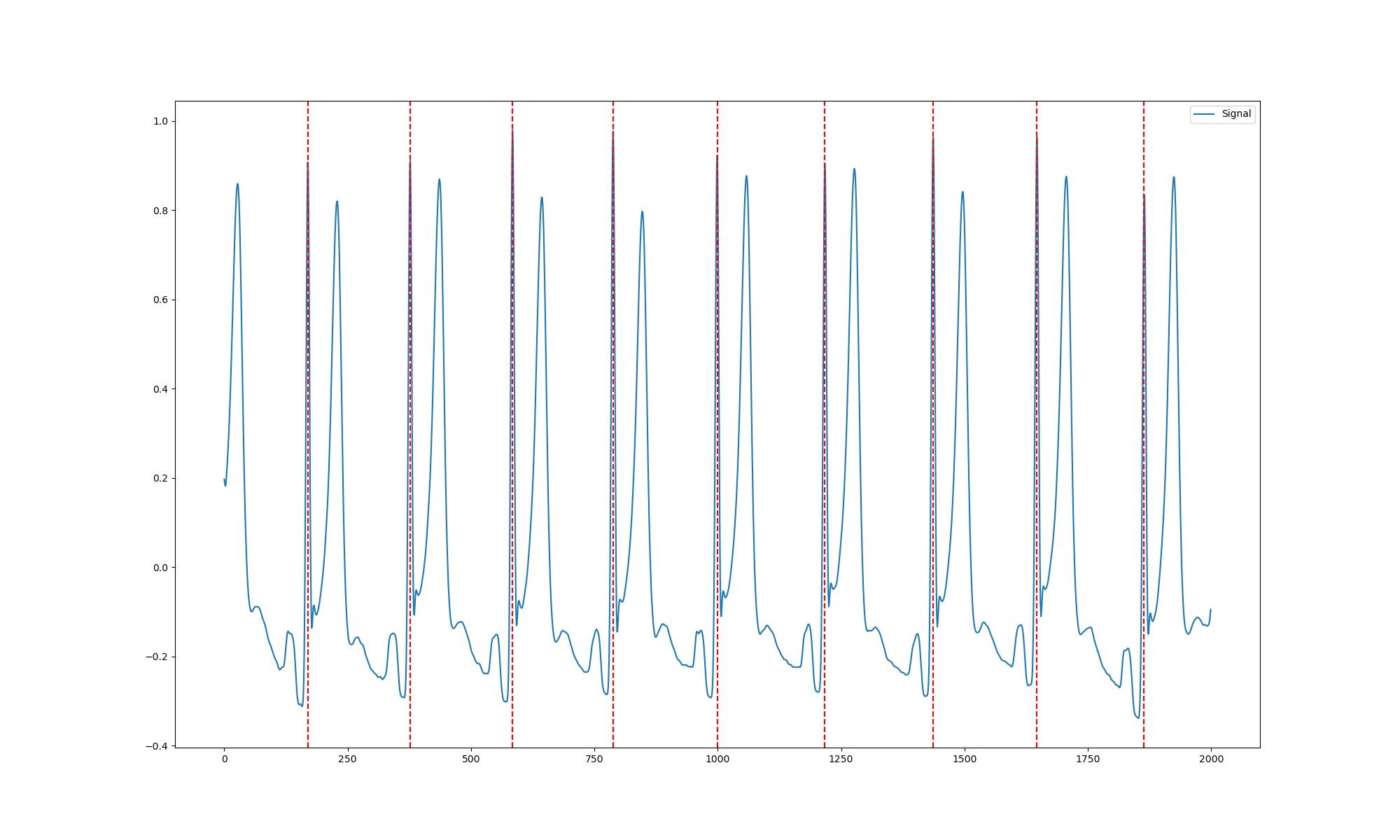 ECG R-peaks