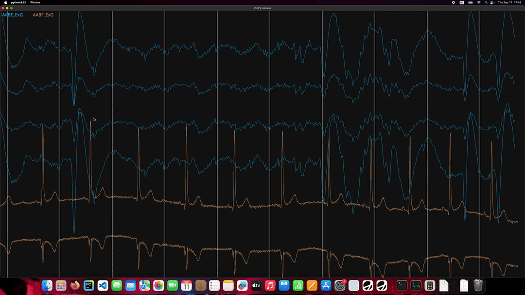 A gif of two Explore Pro streams of EEG and ECG data visualised in real-time.