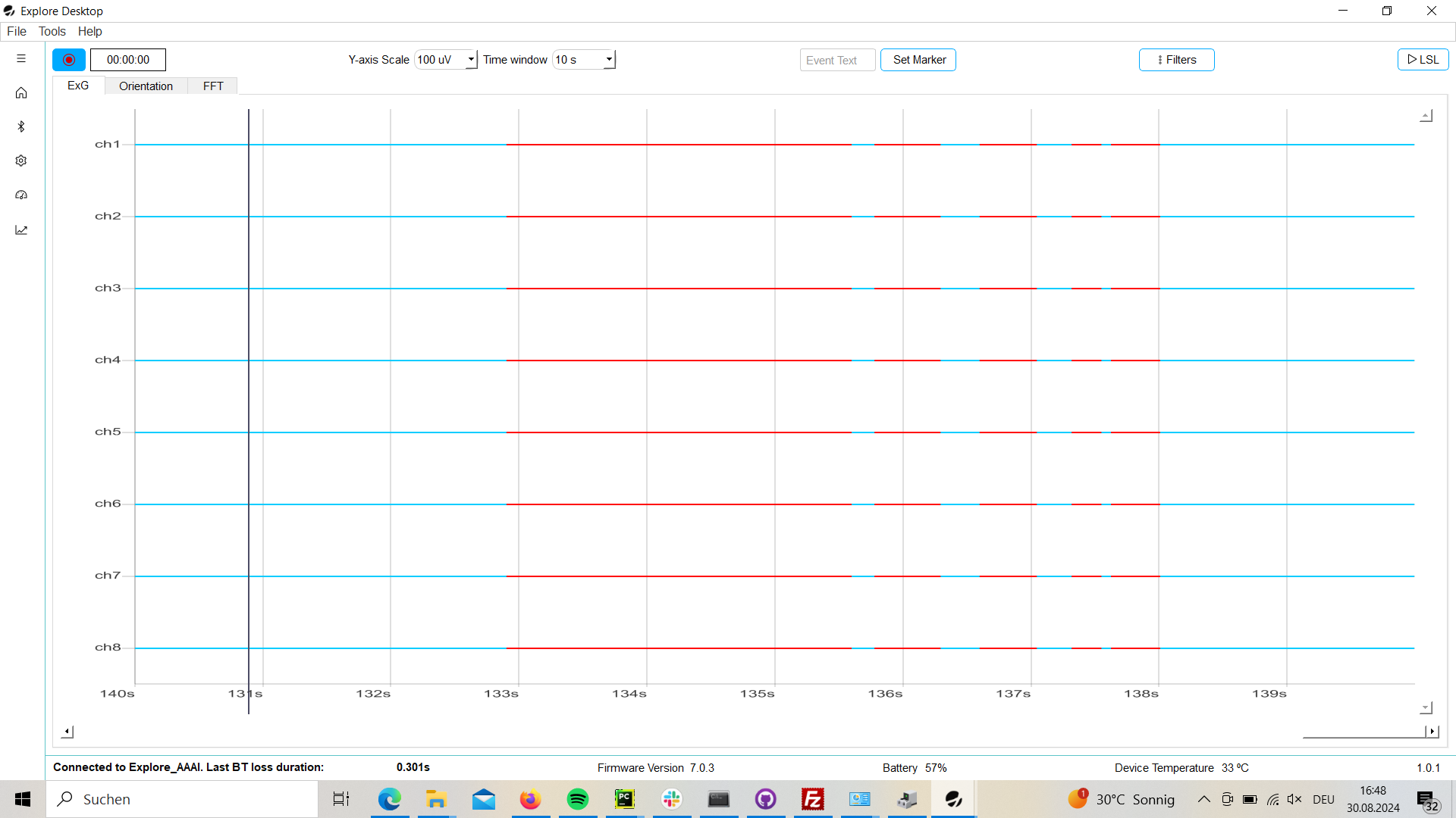 Bluetooth samples lost in seconds in footer