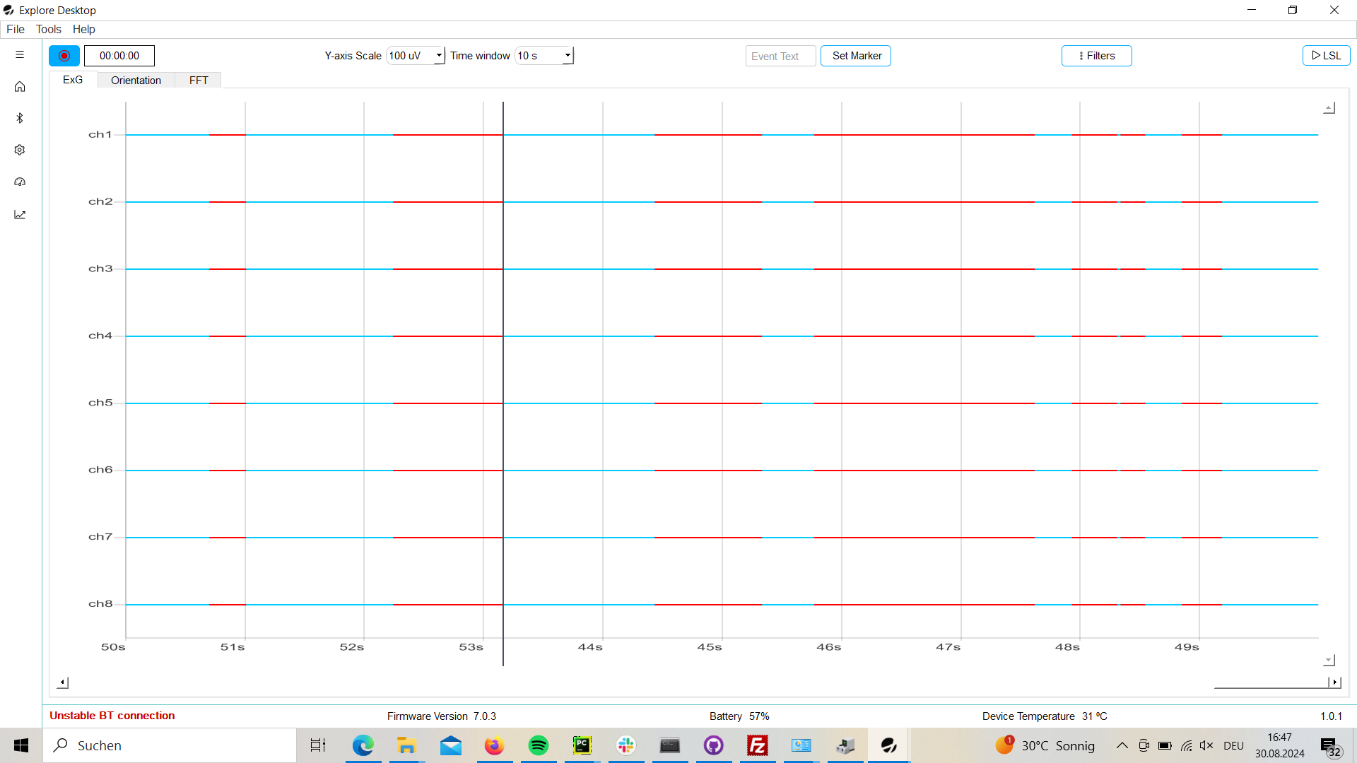 Packet loss visualization