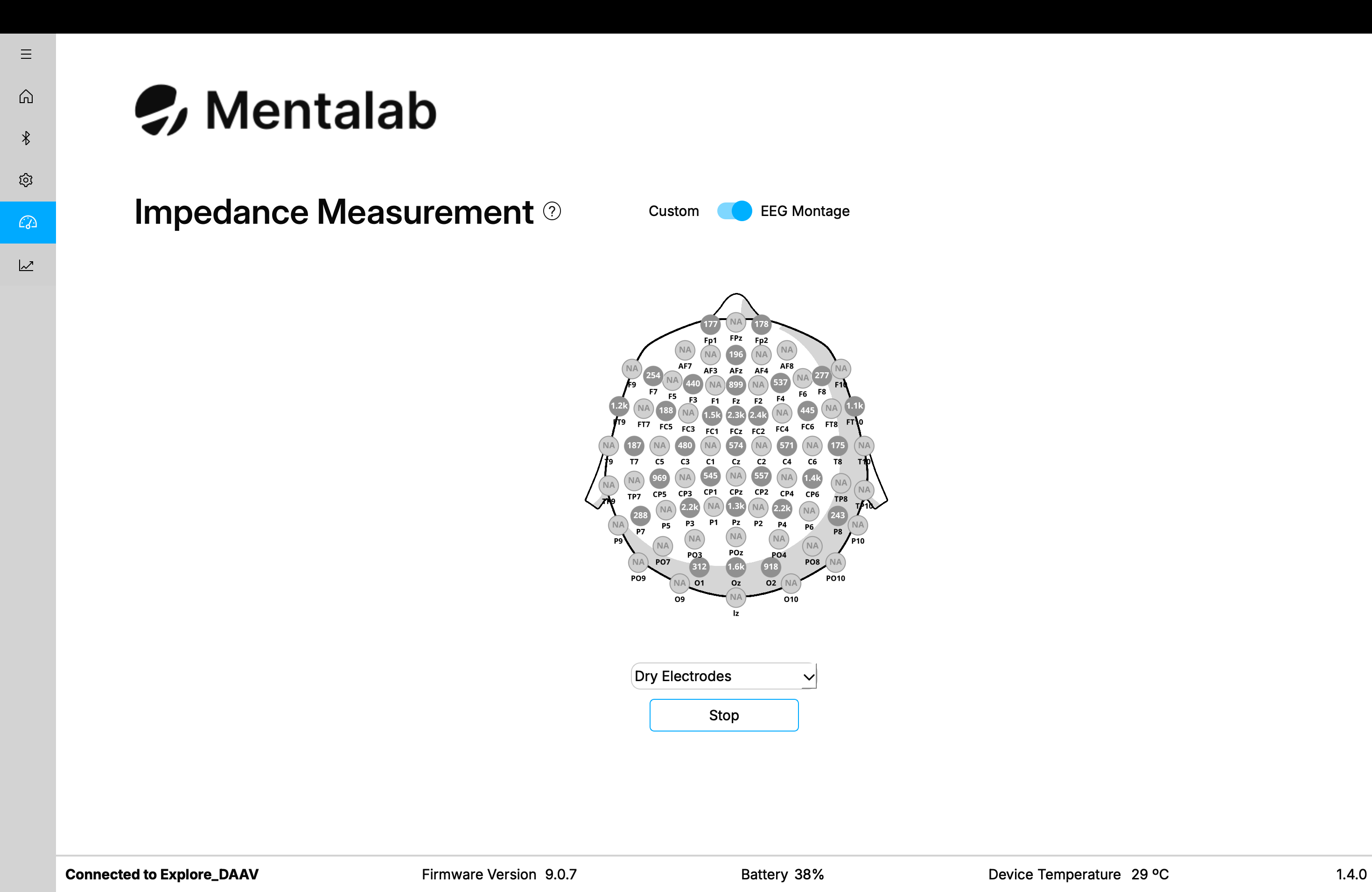 EEG montage view