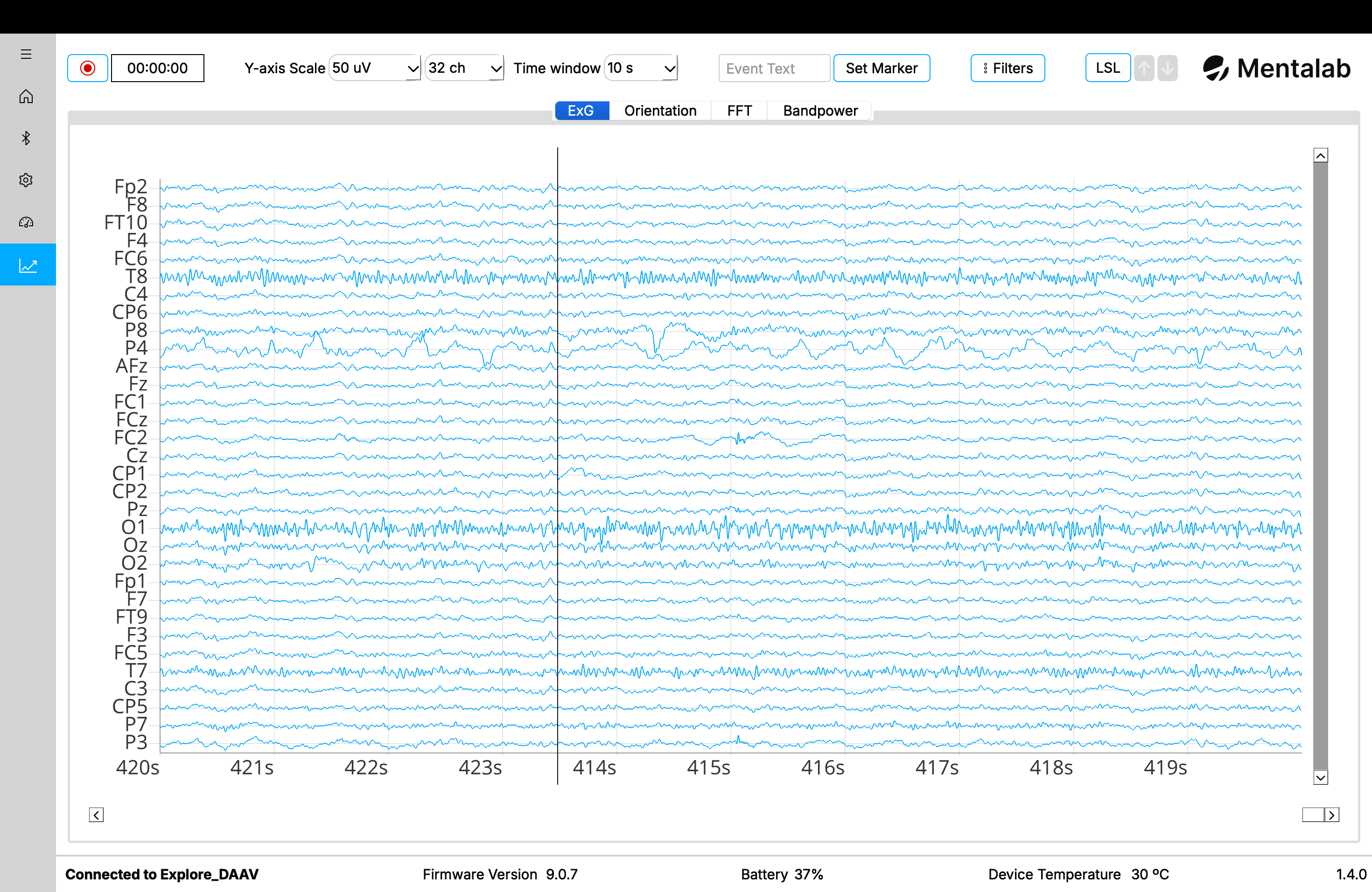 Example of Explore Desktop's ExG plot