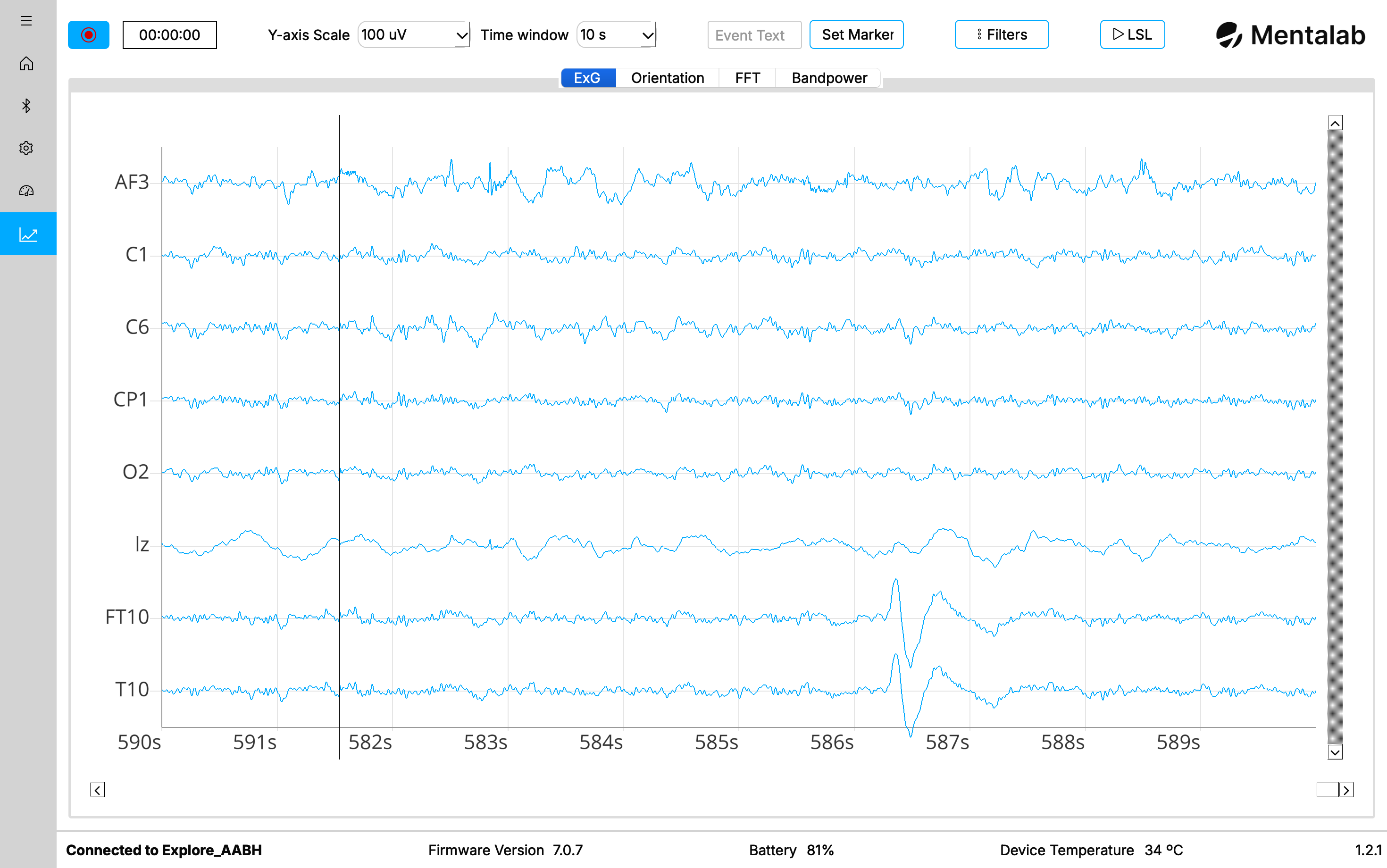Example of Explore Desktop's ExG plot