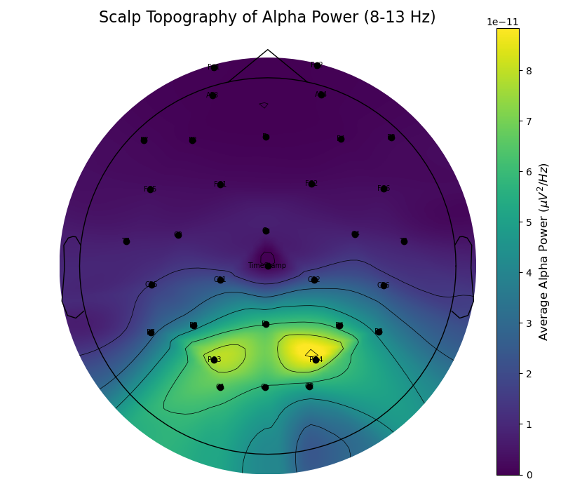Topographic distribution of the alpha band