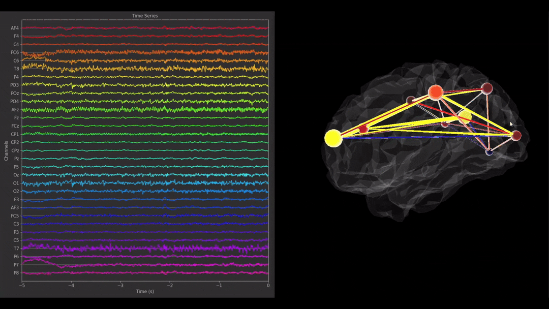 View of the NeuroPype Connectivity Estimation result