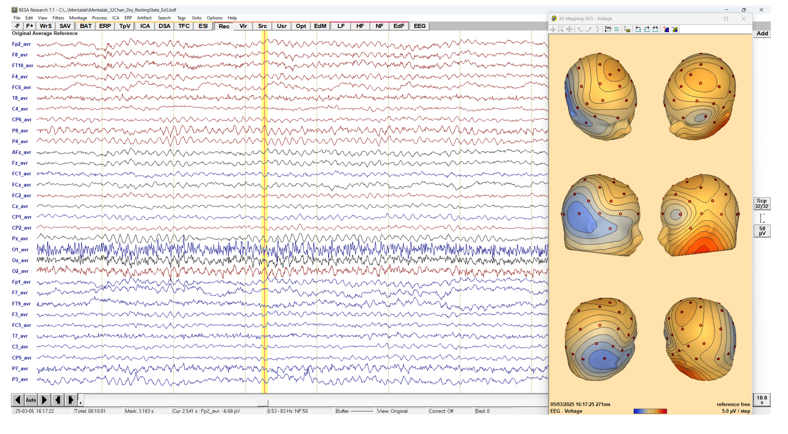 View of the BESA Research Signal view and source estimation