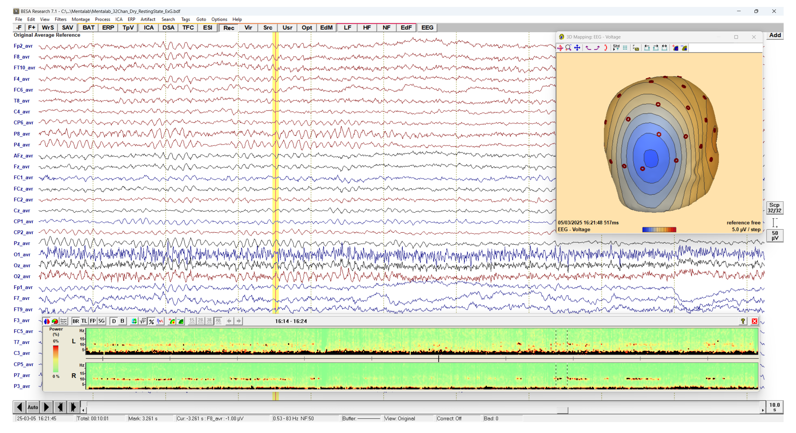 View of the BESA Research Signal view and source estimation