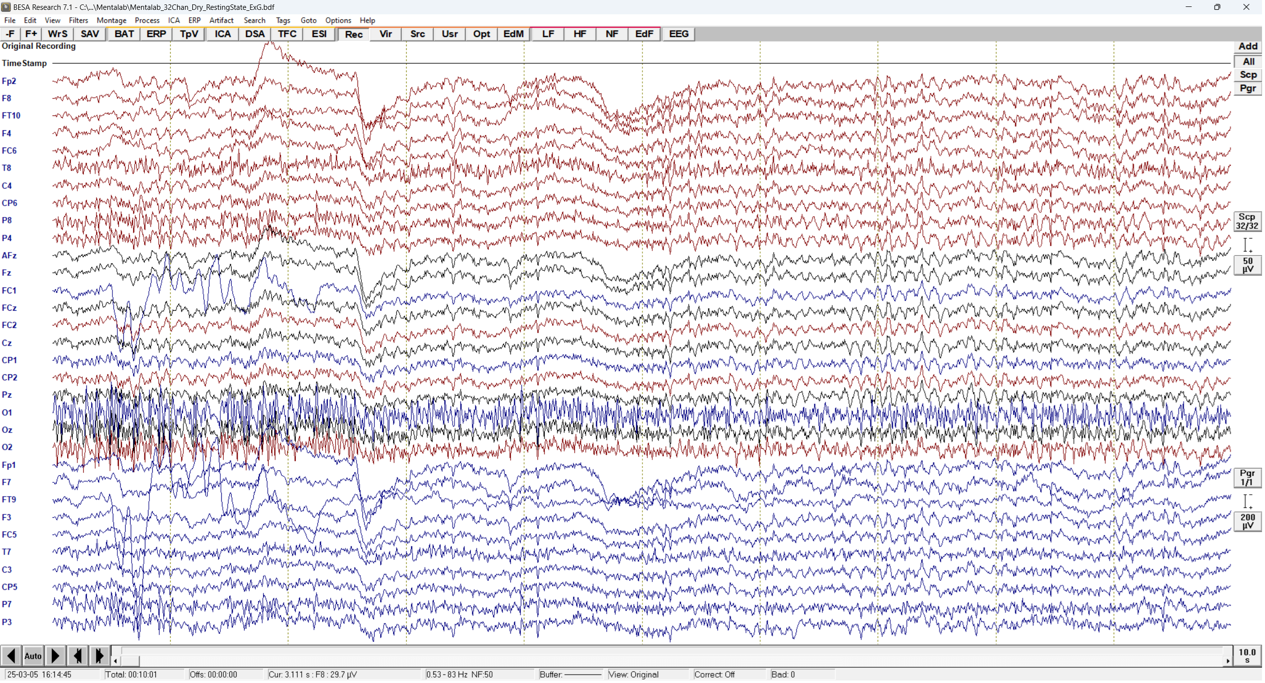 View of the BESA Research Signal view and source estimation