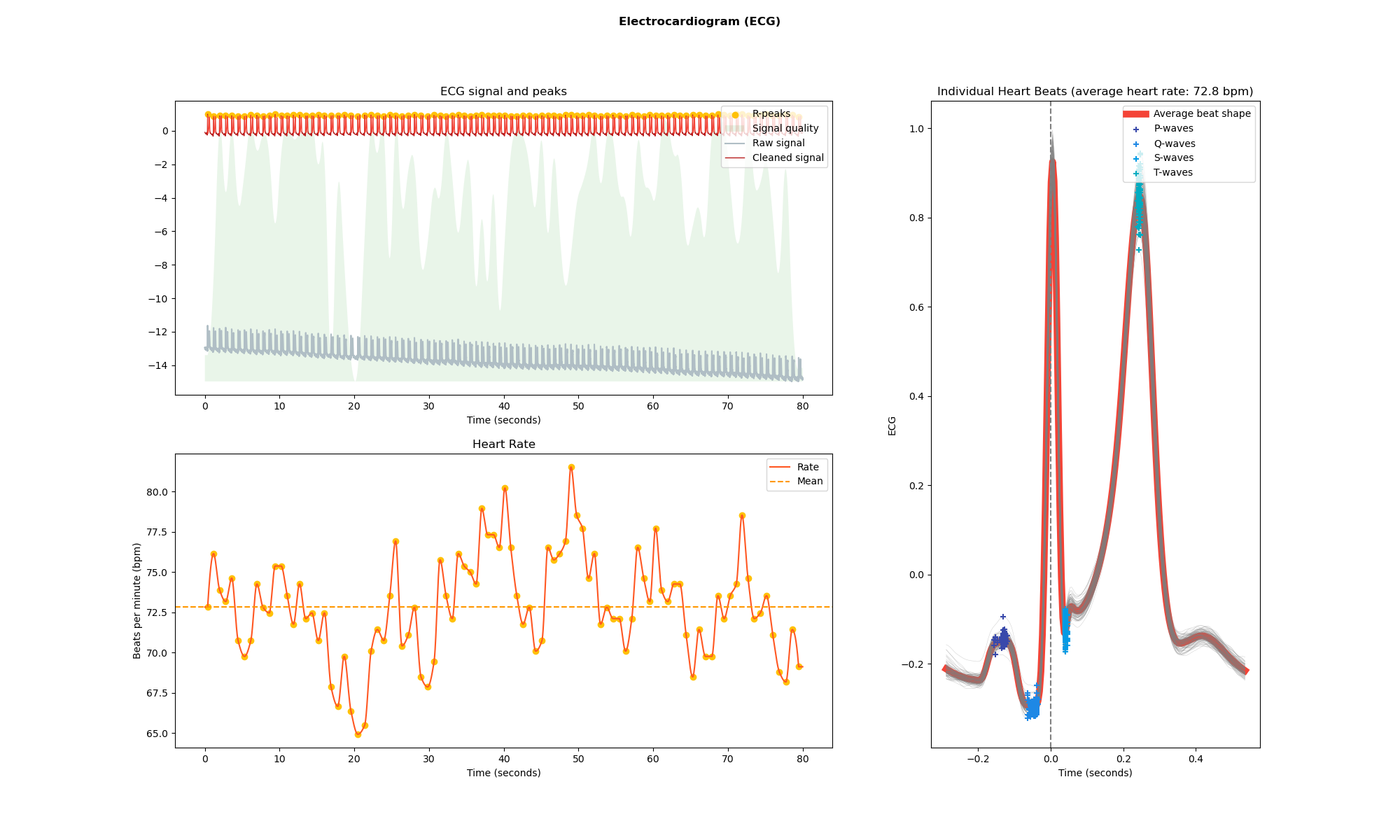 ECG Resting State