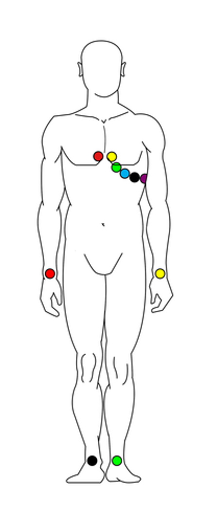 12 lead configuration