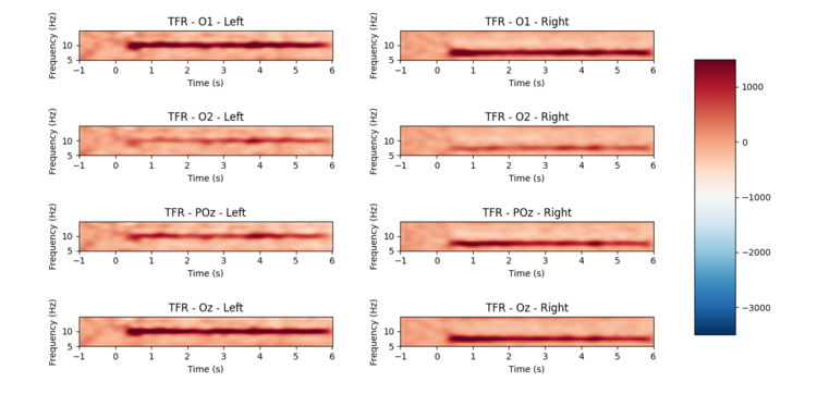 Time-frequency representation for each channel