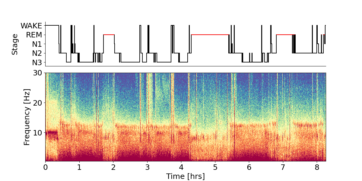 Spectrogram and hypnogram