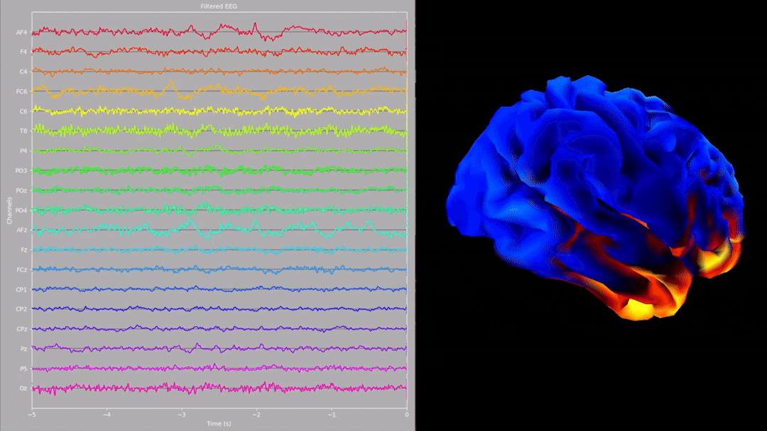 View of the NeuroPype Source localisation result