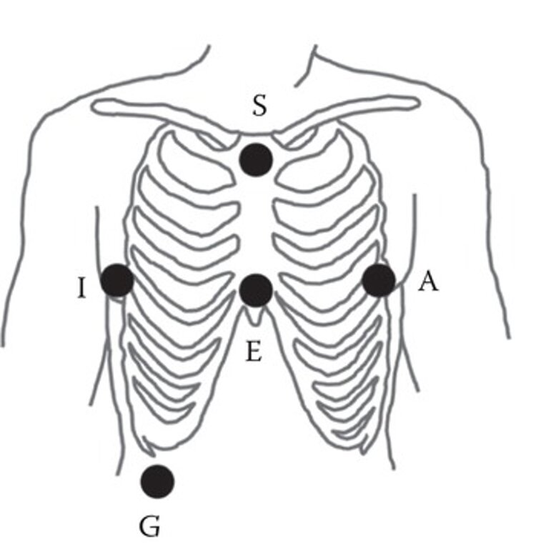 EASI configuration
