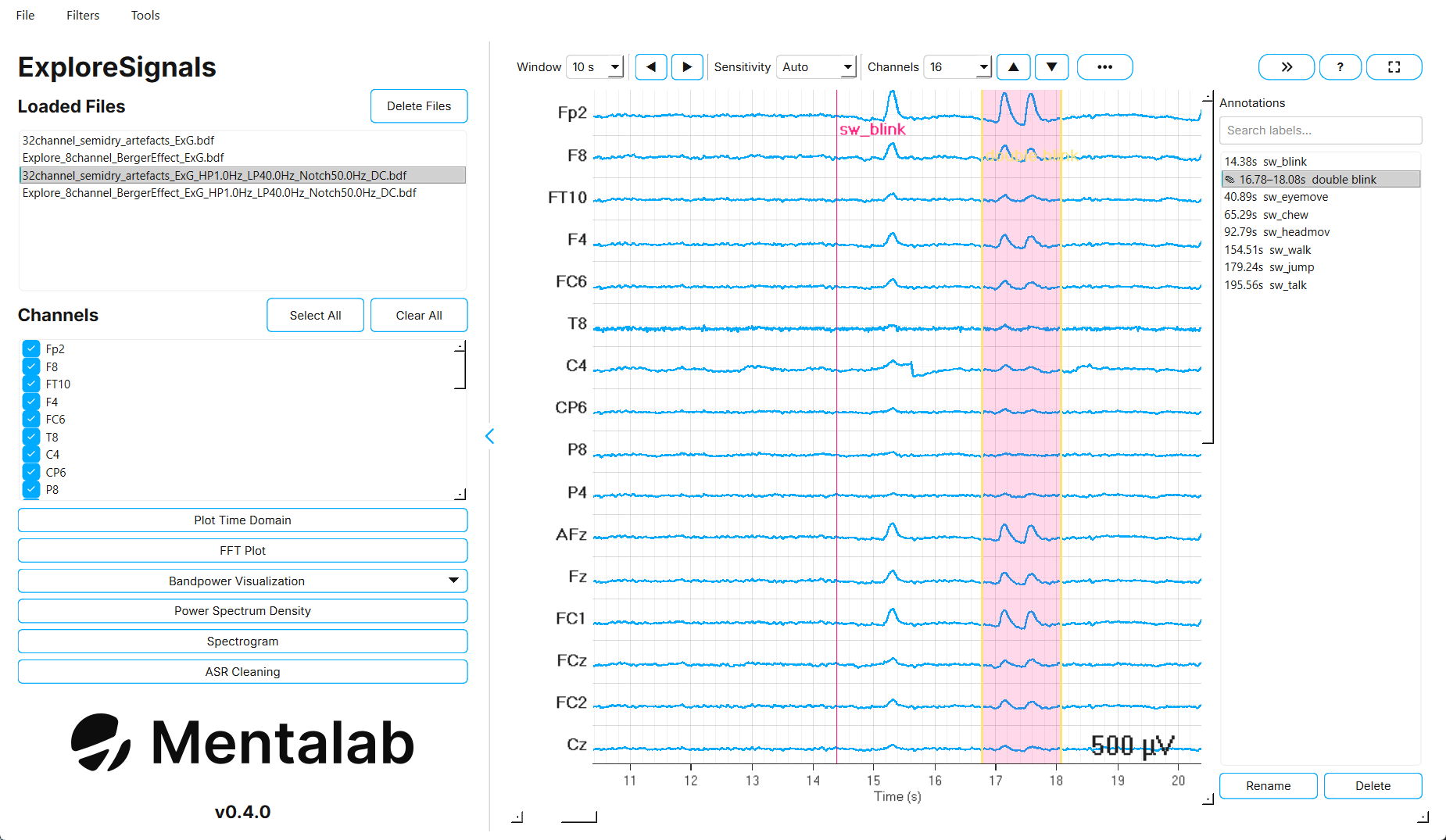 The time-domain viewer with a user annotation labelled double blink selected and the annotation list open on the right.