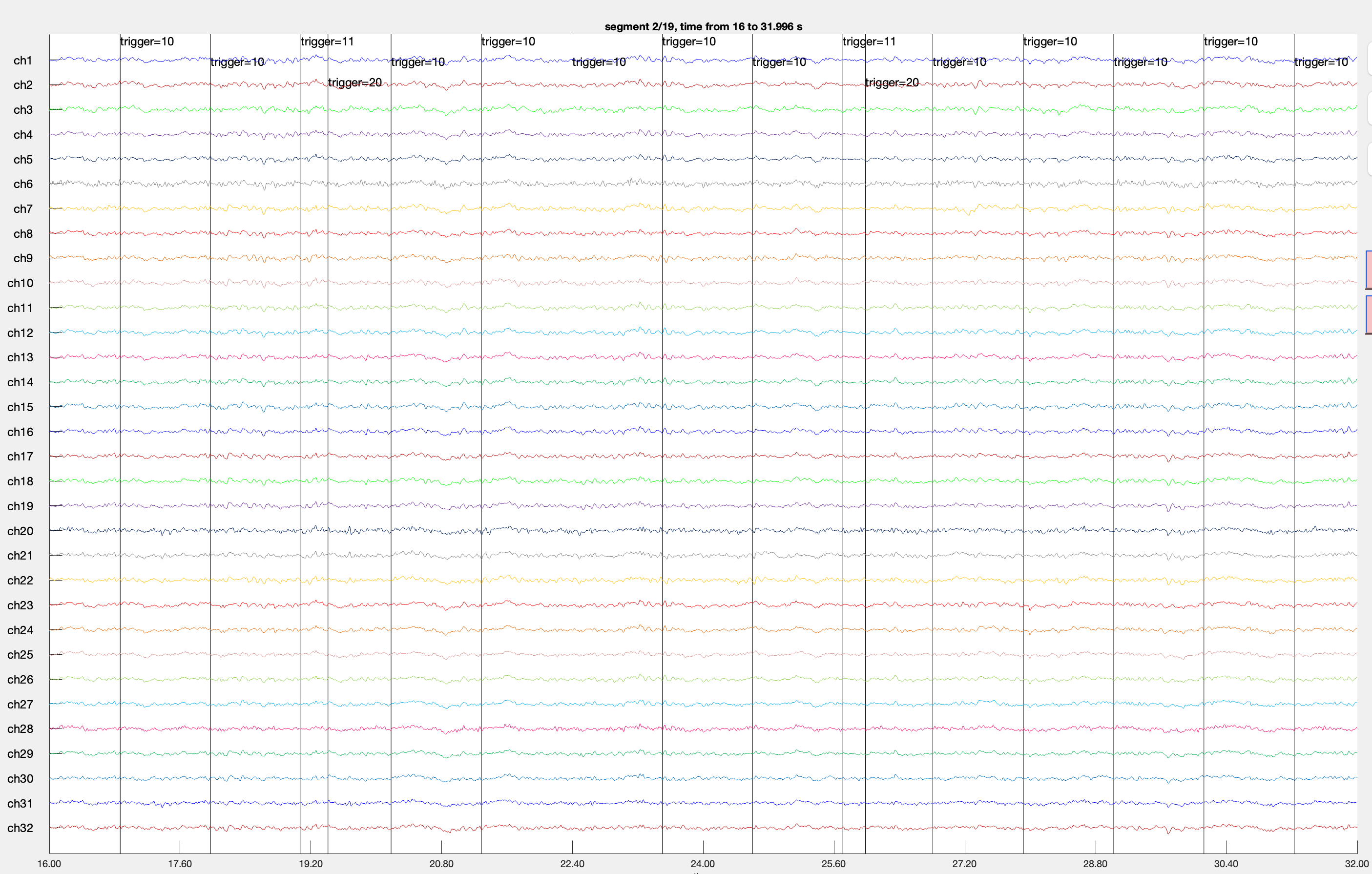 FieldTrip visualization example