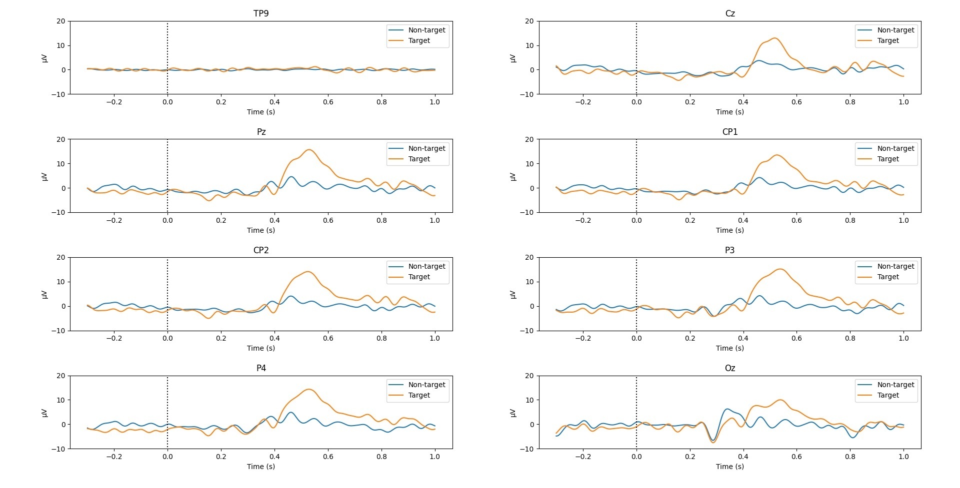P300 wave forms