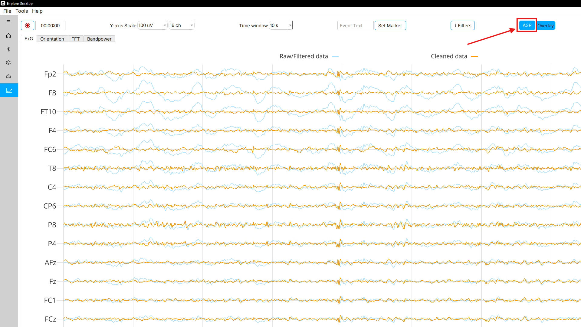 The ASR button in the Visualization page toolbar.